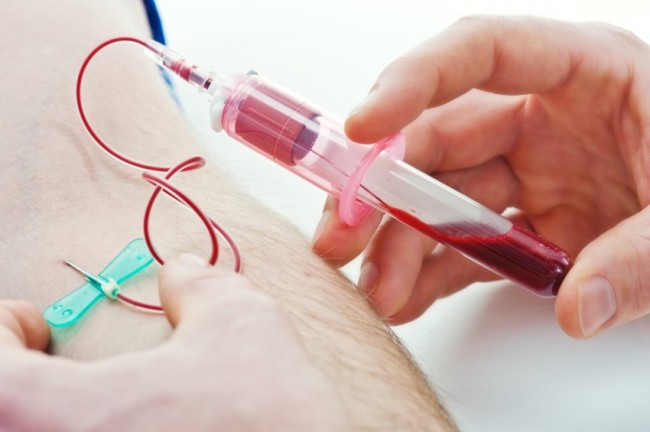 Phlebotomy Training | Could Young Blood Help Prevent Major Diseases?